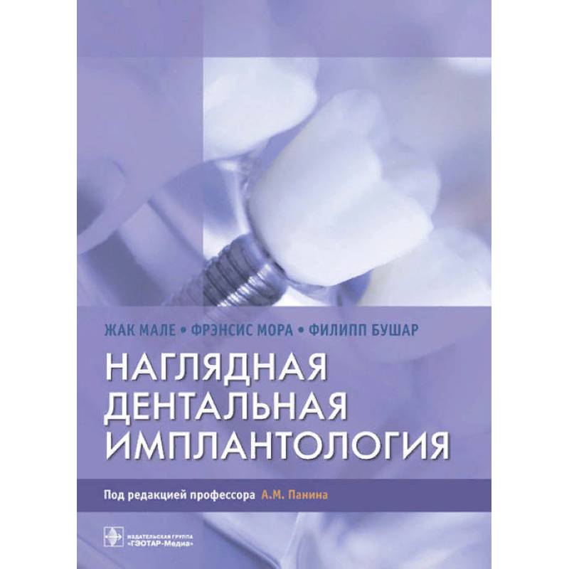Наглядная дентальная имплантология