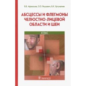 Абсцессы и флегмоны челюстно-лицевой области и шеи Абсцессы и флегмоны челюстно-лицевой области и шеи