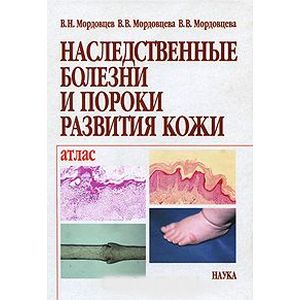 Наследственные болезни и пороки развития кожи. Атлас Наследственные болезни и пороки развития кожи. Атлас