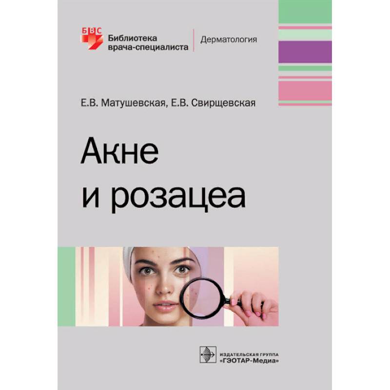 Акне и розацеа Акне и розацеа