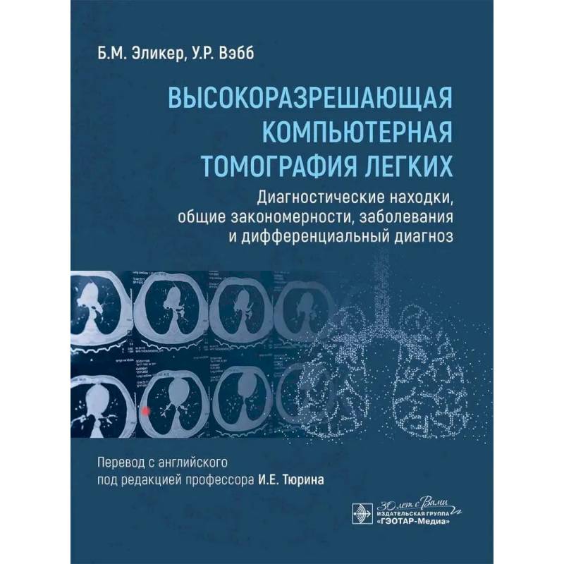 Высокоразрешающая компьютерная томография легких. Диагностические находки, общие закономерности, заболевания и дифференциальный диагноз Высокоразрешающая компьютерная томография легких. Диагностические находки, общие закономерности, заболевания и дифференциальный диагноз