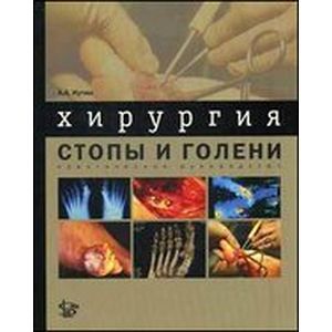 Хирургия стопы и голени: практическое руководство Хирургия стопы и голени: практическое руководство