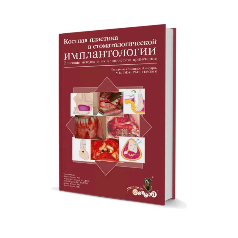 Костная пластика в стоматологической имплантологии. Описание методик и их клинического применения Костная пластика в стоматологической имплантологии. Описание методик и их клинического применения