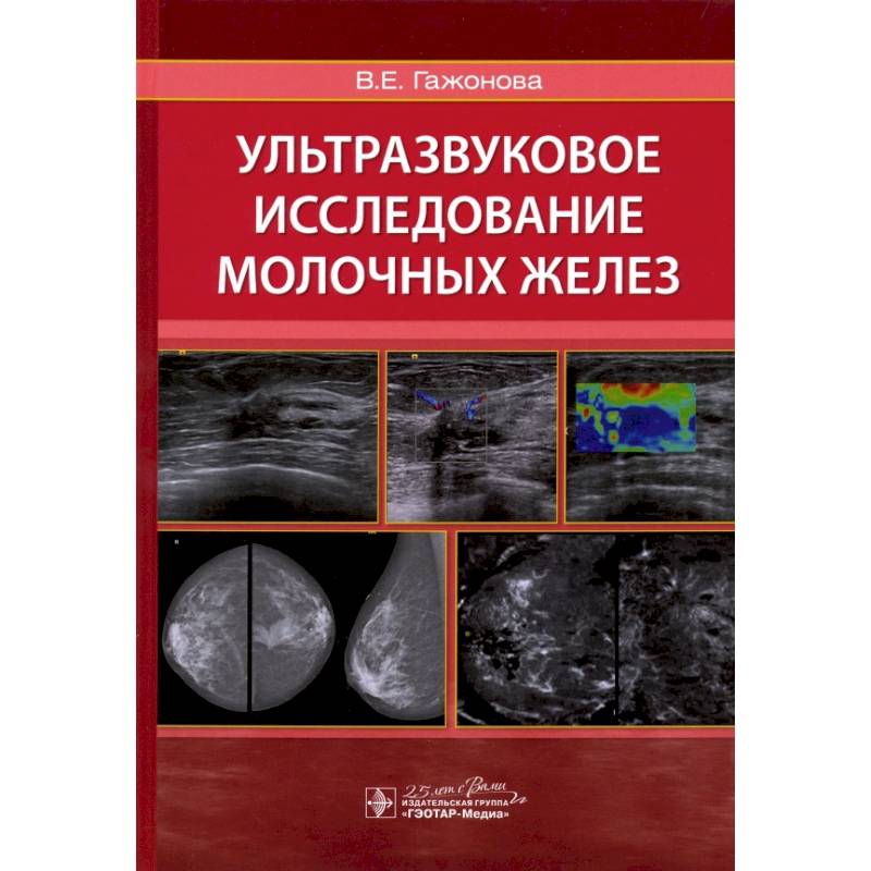 Ультразвуковое исследование молочных желез Ультразвуковое исследование молочных желез