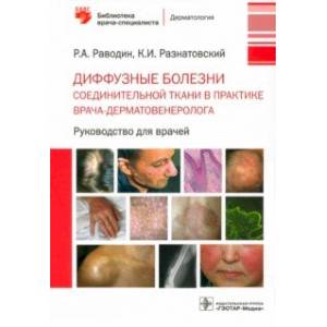 Диффузные болезни соединительной ткани в практике врача-дерматовенеролога