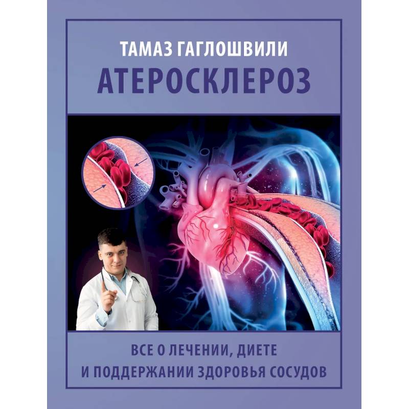 Атеросклероз. Все о лечении, диете и поддержании здоровья сосудов