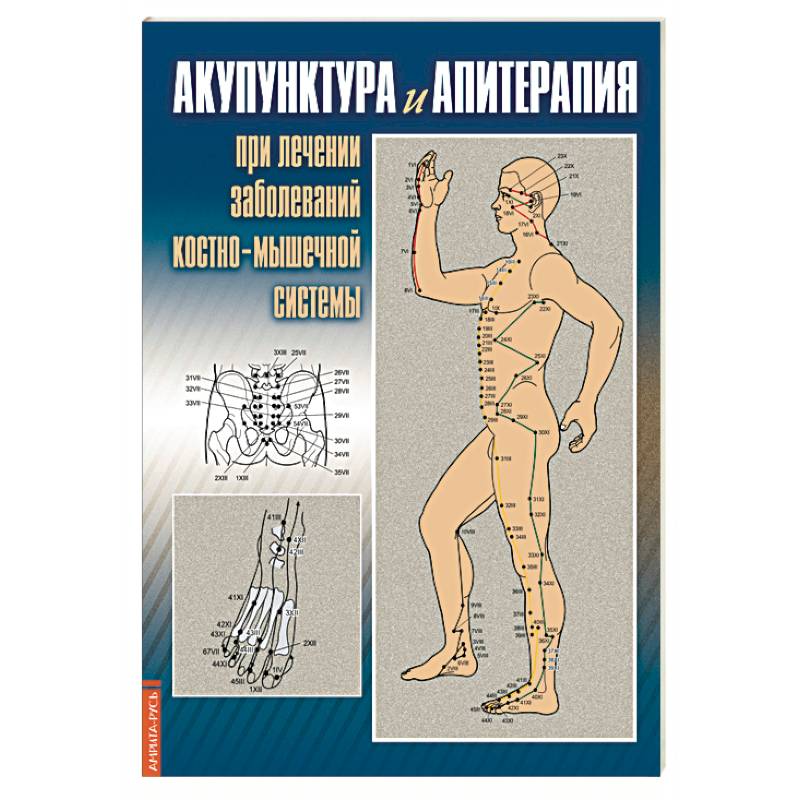 Акупунктура и апитерапия при лечении заболеваний костно-мышечной системы Акупунктура и апитерапия при лечении заболеваний костно-мышечной системы