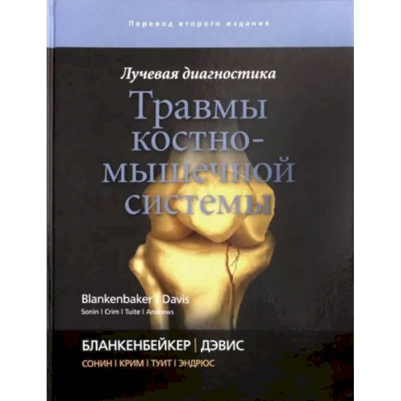 Лучевая диагностика. Травмы костно-мышечной системы Лучевая диагностика. Травмы костно-мышечной системы