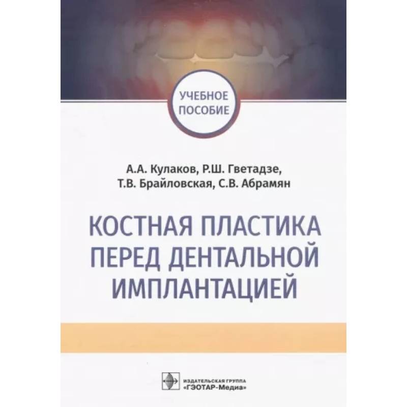 Костная пластика перед дентальной имплантацией Костная пластика перед дентальной имплантацией