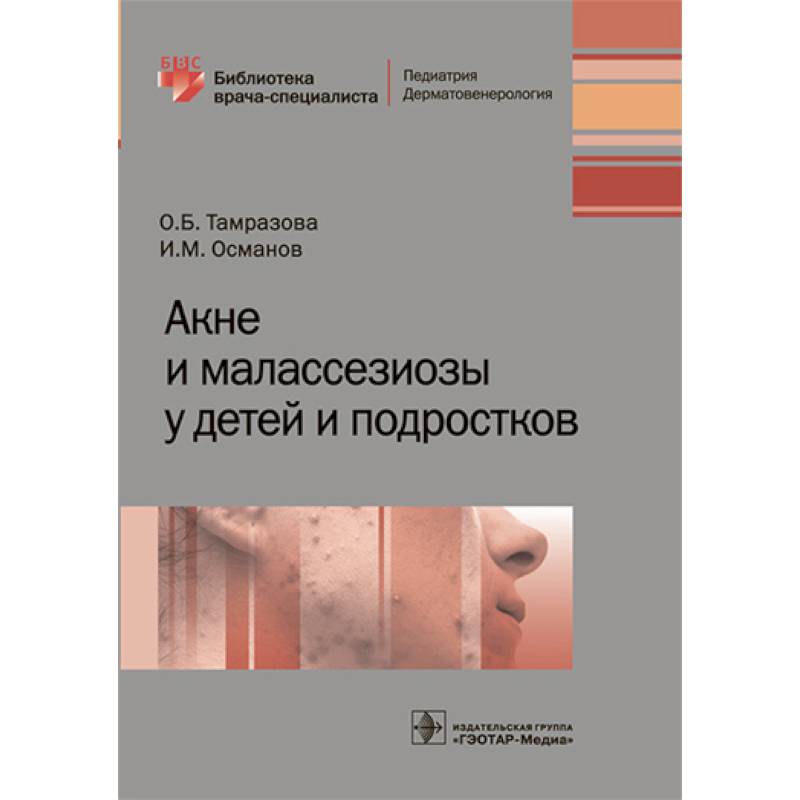Акне и малассезиозы у детей и подростков Акне и малассезиозы у детей и подростков