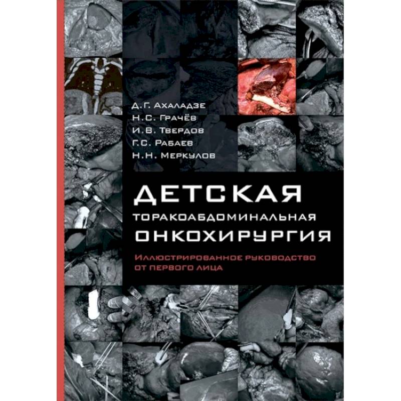 Детская торакоабдоминальная онкохирургия. Иллюстрированное руководство от первого лица Детская торакоабдоминальная онкохирургия. Иллюстрированное руководство от первого лица