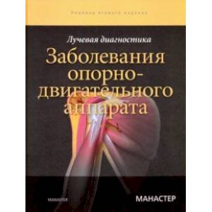 Лучевая диагностика. Заболевания опорно-двигательного аппарата Лучевая диагностика. Заболевания опорно-двигательного аппарата