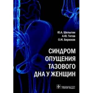 Синдром опущения тазового дна у женщин Синдром опущения тазового дна у женщин