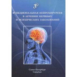 Функциональная нейрохирургия в лечении нервных заболеваний