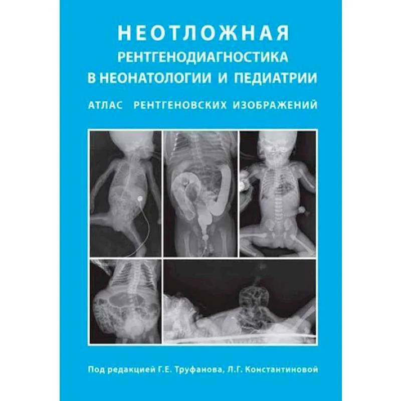 Неотложная рентгенодиагностика в неонатологии и педиатрии Неотложная рентгенодиагностика в неонатологии и педиатрии