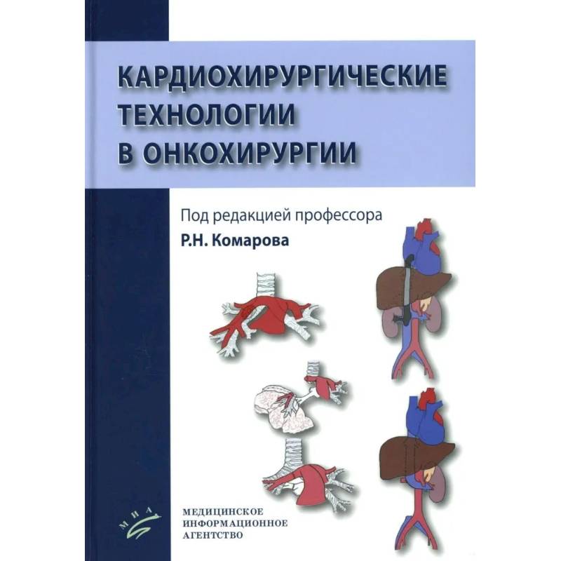 Кардиохирургические технологии в онкохирургии Кардиохирургические технологии в онкохирургии