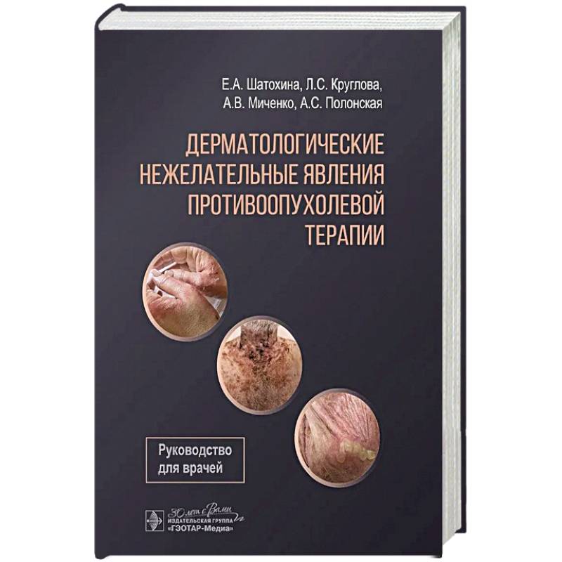 Дерматологические явления противоопухолевой терапии Дерматологические явления противоопухолевой терапии