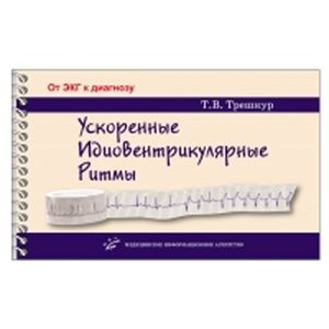 Ускоренные идиовентрикулярные ритмы: клинико-электрокардиографические особенности, систематизация по ЭКГ-характеристикам, дифференцирован