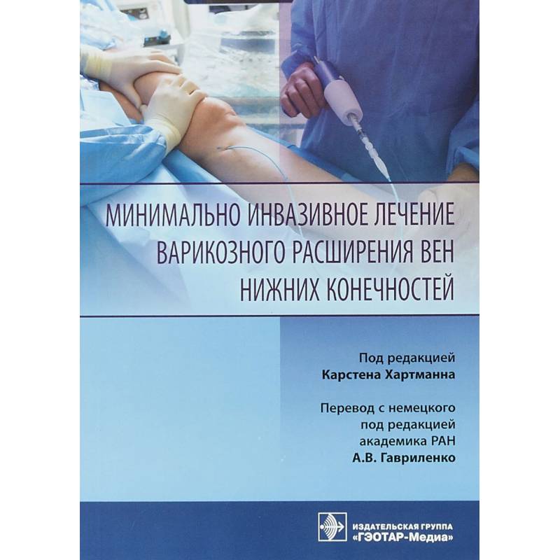 Минимально инвазивное лечение варикозного расширения вен Минимально инвазивное лечение варикозного расширения вен