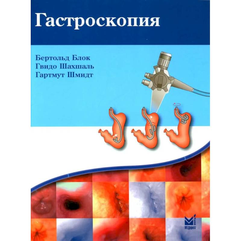 Гастроскопия Гастроскопия
