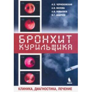 Бронхит курильщика. Клиника, диагностика, лечение Бронхит курильщика. Клиника, диагностика, лечение