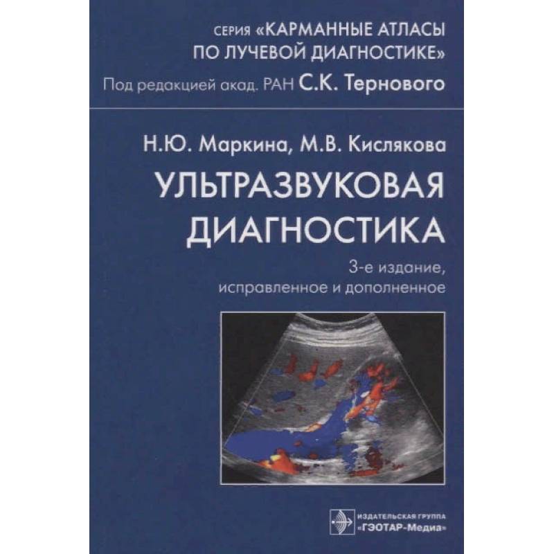 Ультразвуковая диагностика