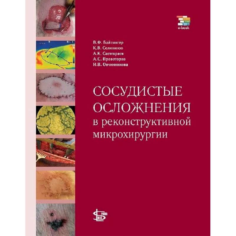 Сосудистые осложнения в реконструктивной микрохирургии Сосудистые осложнения в реконструктивной микрохирургии