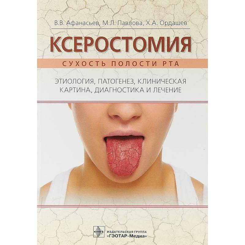 Ксеростомия. Сухость полости рта. Этиология, патогенез, клиническая картина, диагностика и лечение Ксеростомия. Сухость полости рта. Этиология, патогенез, клиническая картина, диагностика и лечение