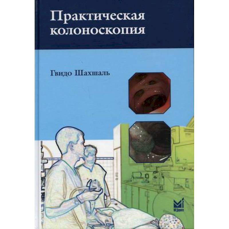 Практическая колоноскопия Практическая колоноскопия
