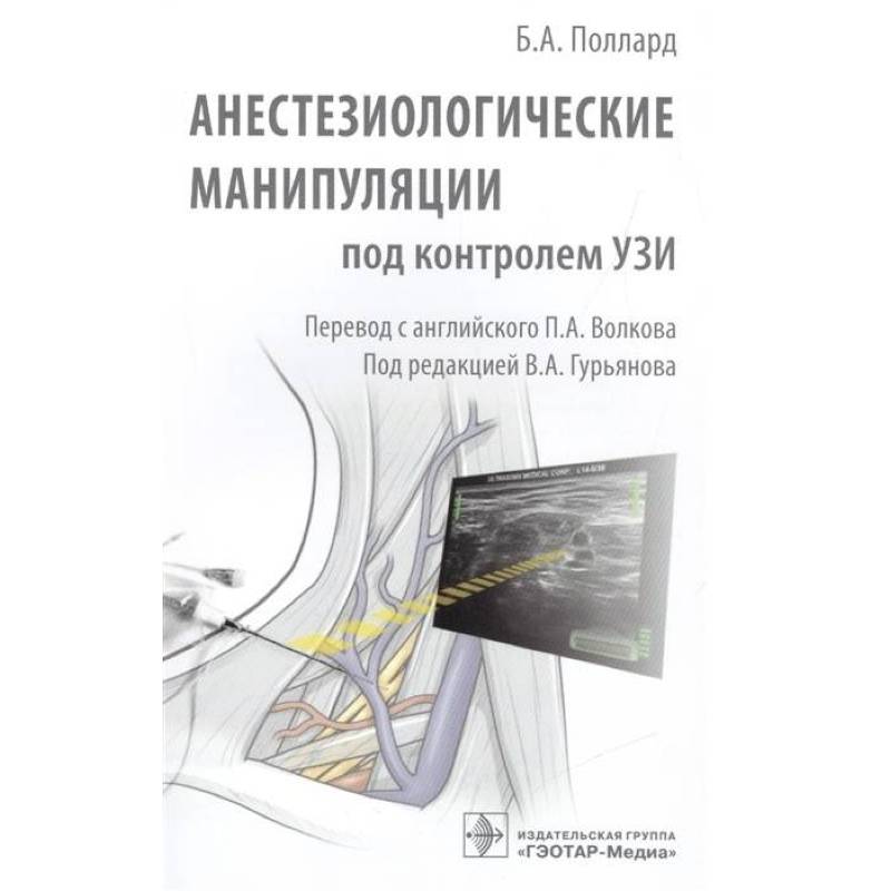 Анестезиологические манипуляции под контролем УЗИ Анестезиологические манипуляции под контролем УЗИ