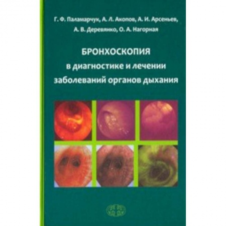 Терапия. Пульмонология, книга Бронхоскопия в диагностике и лечении заболеваний органов дыхания купить по скидке
