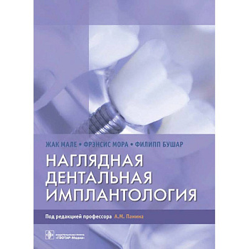 Наглядная дентальная имплантология