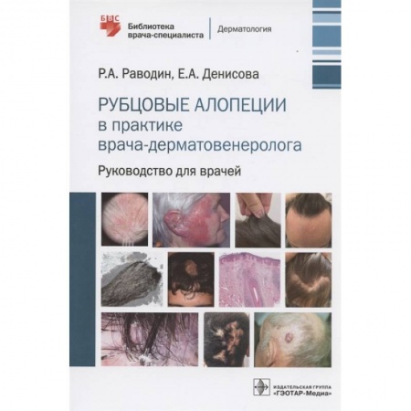 Кожные и венерические болезни, книга Рубцовые алопеции в практике врача-дерматовенеролога. Руководство для врачей купить по скидке