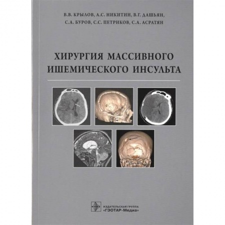Хирургия. Ортопедия, книга Хирургия массивного ишемического инсульта купить по скидке