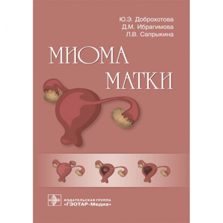 Медицинские энциклопедии и справочники, книга Миома матки купить по скидке