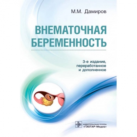 Акушерство и гинекология, книга Внематочная беременность купить по скидке