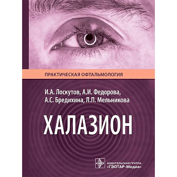 Халазион Халазион