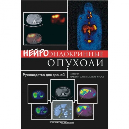 Онкология, книга Нейроэндокринные опухоли. Руководство для врачей купить по скидке