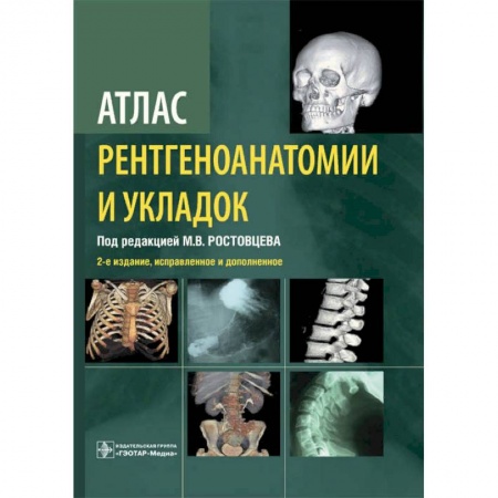 УЗИ. ЭКГ. Томография. Рентген, книга Атлас рентгеноанатомии и укладок.Руководство для врачей купить по скидке