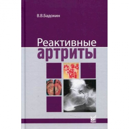 Другие виды специальной медицины, книга Реактивные артриты. Урогенитальные и постэнтероколитические купить по скидке
