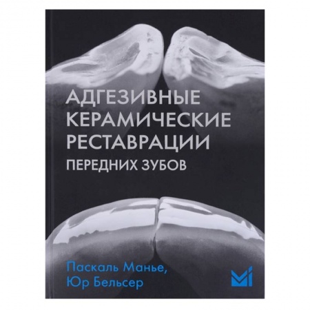 Стоматология, книга Адгезивные керамические реставрации передних зубов купить по скидке