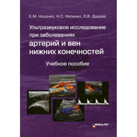 УЗИ. ЭКГ. Томография. Рентген, книга Ультразвуковое исследование при заболеваниях артерий и вен нижних конечностей купить по скидке