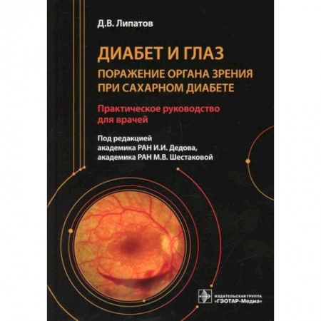 Офтальмология, книга Диабет и глаз. Поражение органа зрения при сахарном диабете купить по скидке