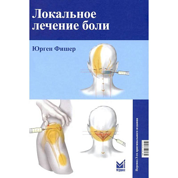 Локальное лечение боли Локальное лечение боли