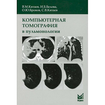 Компьютерная томография в пульмонологии Компьютерная томография в пульмонологии