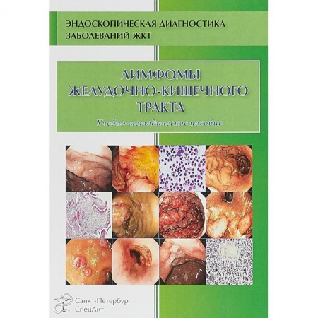 Онкология, книга Лимфомы желудочно-кишечного тракта. Учебно-методическое пособие купить по скидке