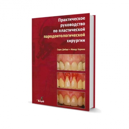 Стоматология, книга Практическое руководство по пластической парадонтологической хирургии купить по скидке