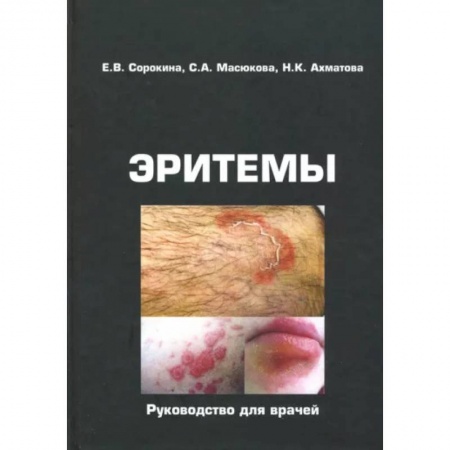 Кожные и венерические болезни, книга Эритемы. Руководство для врачей купить по скидке