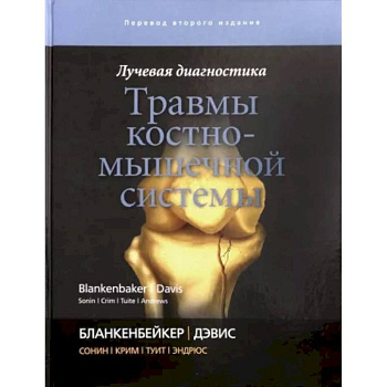 Лучевая диагностика. Травмы костно-мышечной системы Лучевая диагностика. Травмы костно-мышечной системы