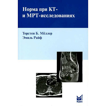 Норма при КТ- и МРТ-исследованиях Норма при КТ- и МРТ-исследованиях